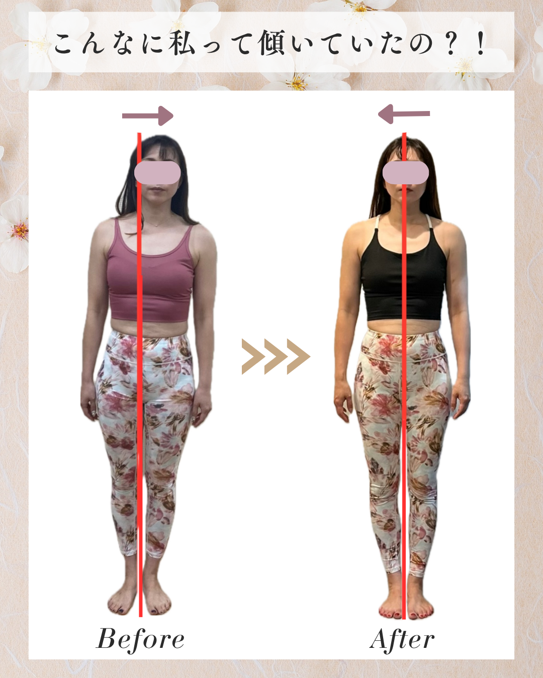 姿勢の崩れとお腹周り Before/After