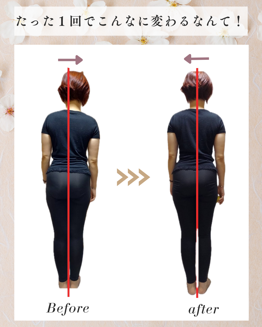 身体の歪み Before/After