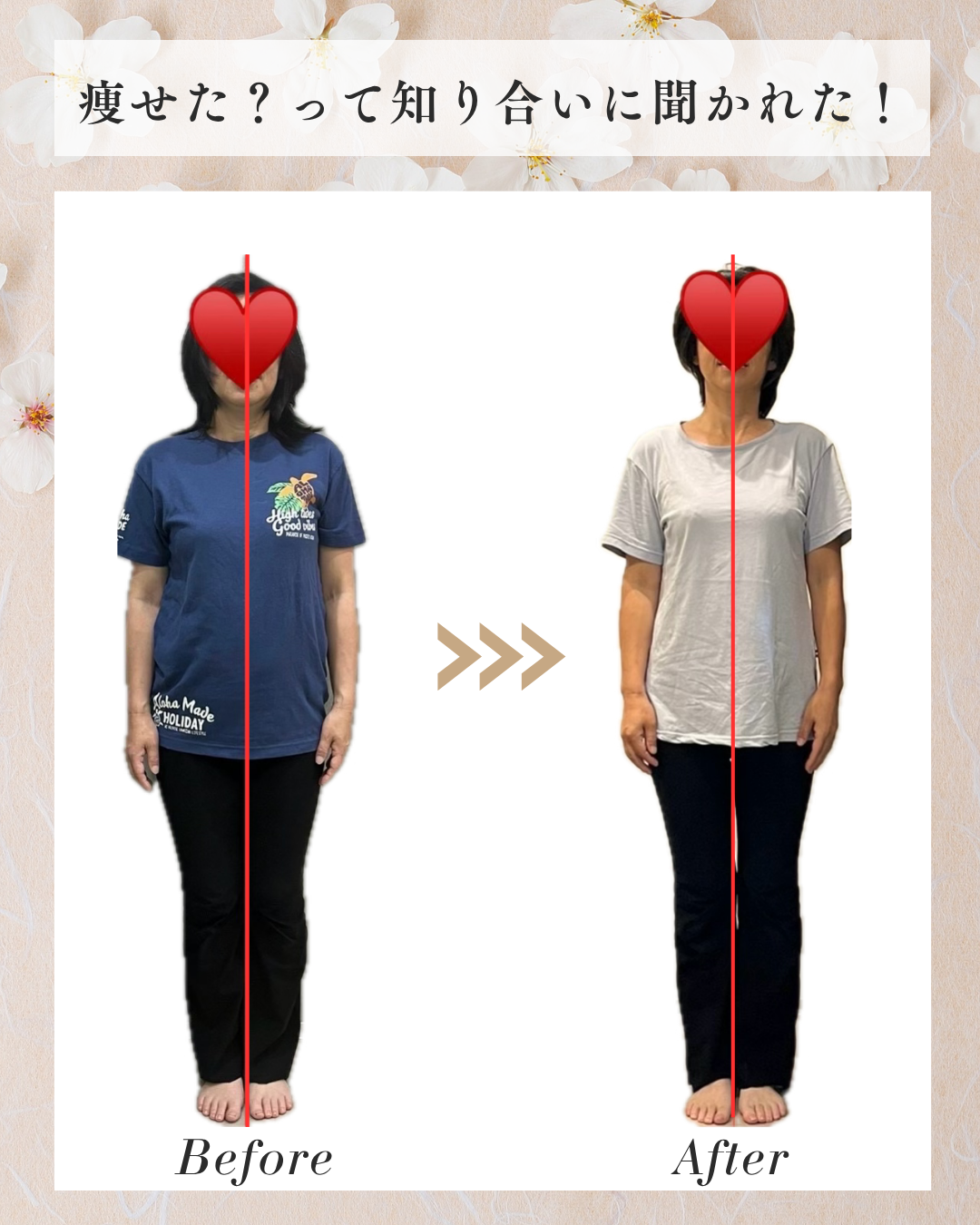巻き肩 Before/After